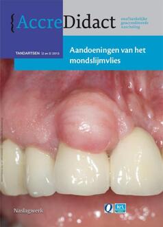 Prelum Uitgevers Aandoeningen van het mondslijmvlies - Boek Isaac van der Waal (9089761225)