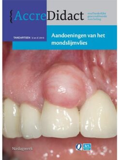 Prelum Uitgevers Aandoeningen van het mondslijmvlies - Boek Isaac van der Waal (9089761225)
