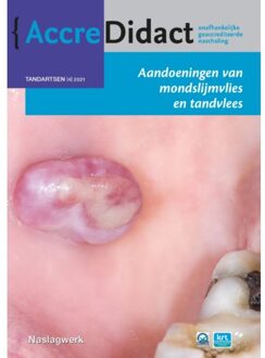 Prelum Uitgevers Aandoeningen Van Mondslijmvlies En Tandvlees - Accredidact - Isaäc van der Waal