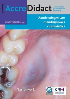 Prelum Uitgevers AccreDidact MH2021-2 -   Aandoeningen van mondslijmvlies en tandvlees