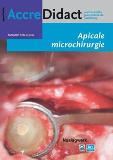 Prelum Uitgevers AccreDidact TA2020-3 -   Apicale microchirurgie