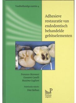 Prelum Uitgevers Adhesieve restauratie van endodontisch behandelde gebitselementen - Boek Francesco Mannocci (9085620589)
