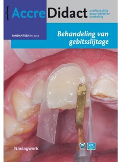 Prelum Uitgevers Behandeling van gebitsslijtage - Boek Peter Wetselaar (9089762779)