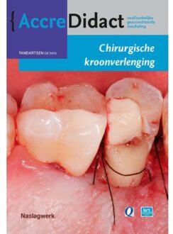 Prelum Uitgevers Chirurgische kroonverlenging - Boek S. Paraskevas (9089761950)