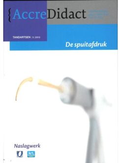 Prelum Uitgevers de spuitafdruk - Boek Prelum Uitgevers (9089760776)