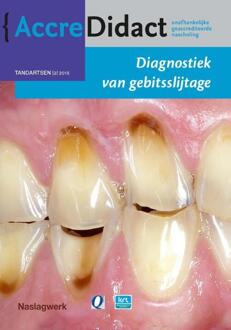 Prelum Uitgevers Diagnostiek van gebitsslijtage - Boek Peter Wetselaar (9089761861)