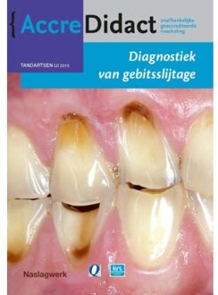 Prelum Uitgevers Diagnostiek van gebitsslijtage - Boek Peter Wetselaar (9089761861)
