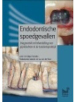 Prelum Uitgevers Endodontische spoedgevallen - Boek Edgar Schäfer (9085620635)
