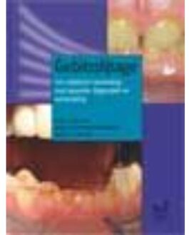 Prelum Uitgevers Gebitsslijtage - Boek C. de Baat (9085620201)