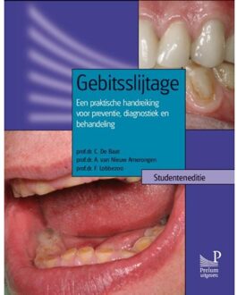 Prelum Uitgevers Gebitsslijtage / Studenteneditie - Boek C. de Baat (9085620554)