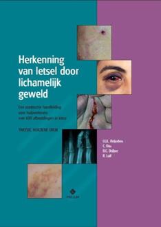 Prelum Uitgevers Herkenning van letsel door lichamelijk geweld - Boek U.J.L. Reijnders (9085621550)