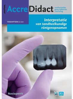 Prelum Uitgevers Interpretatie Van Tandheelkundige Röntgenopnamen - Accredidact - Paul van der Stelt