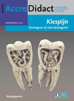 Prelum Uitgevers Kiespijn, dentogeen of niet-dentogeen? - Boek Jan Warnsinck (9089762272)