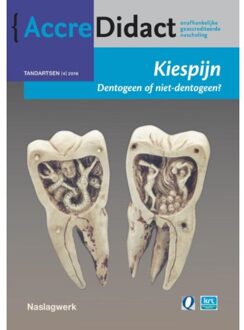 Prelum Uitgevers Kiespijn, dentogeen of niet-dentogeen? - Boek Jan Warnsinck (9089762272)