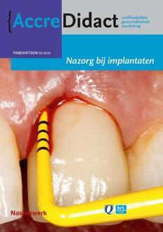 Prelum Uitgevers Nazorg bij implantaten - Boek Gordon van der Avoort (9089761624)