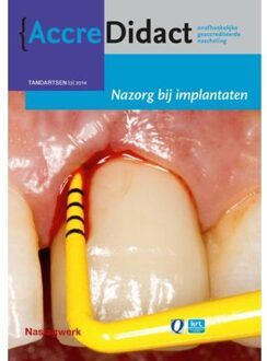 Prelum Uitgevers Nazorg bij implantaten - Boek Gordon van der Avoort (9089761624)