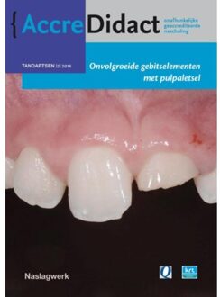 Prelum Uitgevers Onvolgroeide gebitselementen met pulpaletsel - Boek Marga Ree (9089762108)