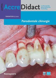 Prelum Uitgevers Parodontale Chirurgie - Accredidact - Alexander Verhelst