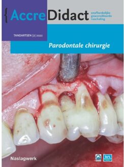 Prelum Uitgevers Parodontale Chirurgie - Accredidact - Alexander Verhelst