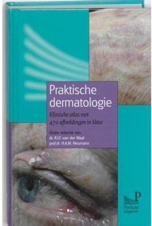 Prelum Uitgevers Praktische dermatologie - Boek Prelum Uitgevers (9085620600)