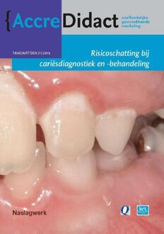 Prelum Uitgevers Risicoschatting bij cariësdiagnostiek en -behandeling gebaseerd op risicoschatting - Boek Cor van Loveren (9089761780)