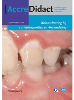 Prelum Uitgevers Risicoschatting bij cariësdiagnostiek en -behandeling gebaseerd op risicoschatting - Boek Cor van Loveren (9089761780)
