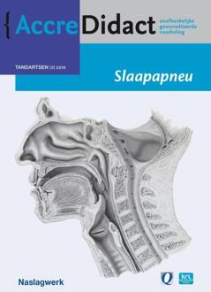 Prelum Uitgevers Slaapapneu - Boek Aarnoud Hoekema (9089762191)