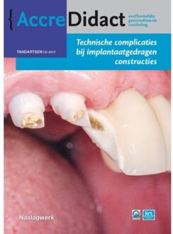 Prelum Uitgevers Technische complicaties bij implantaatgedragen constructies - Boek Gordon van der Avoort (9089762493)