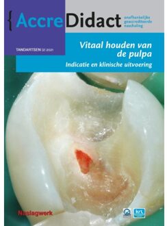 Prelum Uitgevers Vitaal Houden Van De Pulpa - Accredidact - Till Dammaschke