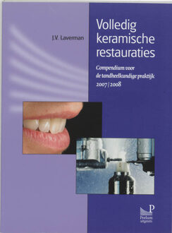 Prelum Uitgevers Volledig keramische restauraties - Boek J.V. Laverman (908562049X)