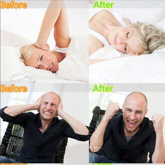 Product Siliconen Gebitsbeschermer Voorkomen Night Sleep Aid Gereedschap Tanden Bruxisme Slijpen Waardoor Product Sleep Aid Gereedschap