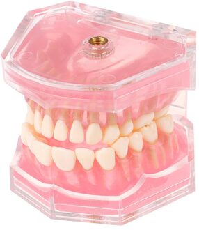 Professionele Dental Standaard Model Met Uitneembare Tanden Dental Studie Teach Tanden Model