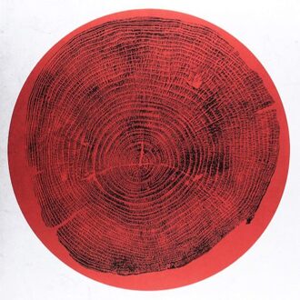 Q: Transient Global Amnesia