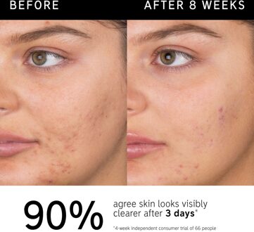 Reiniger met Salicylzuur 60 ml