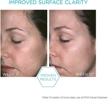 Restore Facial Cleanser 200 ml