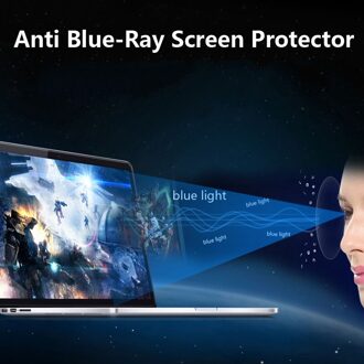 Set Van 2 Anti Blue-Ray 11.6 "Screen Protector Guard Cover Voor Dell Inspiron 11 3162 3168 11.6-Inch