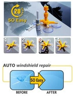 Sikeo 4 bezinksel Professionele DIY Auto Voorruit Chip Repair Kit tools Auto Glas Voorruit reparatie set Auto Styling