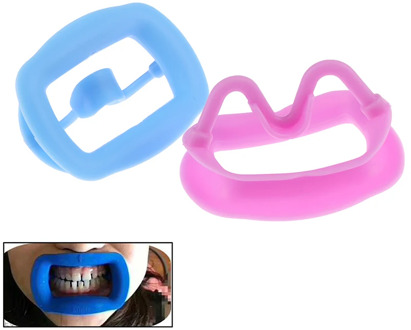 Silicone Dental Mouth Opener Dental Orthodontic Cheek Retracor Intraoral Cheek Lip Retractor Mouth Opening Device Oral Care