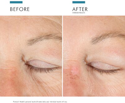 SkinCeuticals A.G.E. Advanced Eye voor Donkere Kringen en Rimpels 15ml