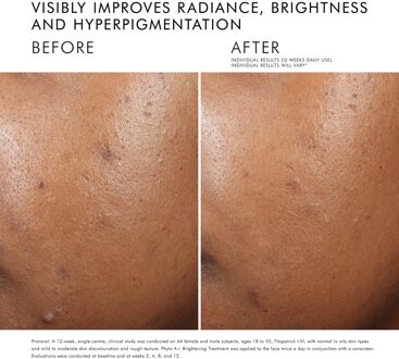 SkinCeuticals Phyto A+ Verhelderende Behandeling 30 ml