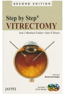 Step By Step Vitrectomy - Martinez-Toldos, Jose J., M.D.,