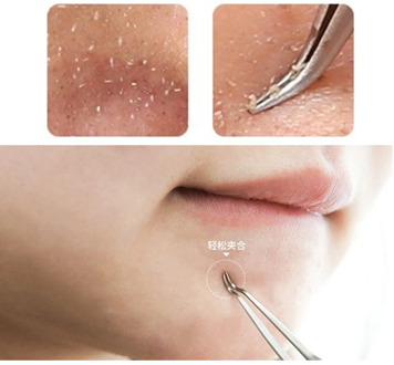 Straight Bend Curved Blackhead Acne Clip Tweezer Pimple Comedone Remover Kit Face Cleaner