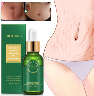 Stretch Marks Remover Essential Oil Skin Care Treatment Cream for Stretch Mark Removal Maternity Slackline for Pregnant Oils