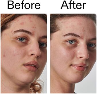 Super Solutions 10% Urea Moisturizer 50 ml