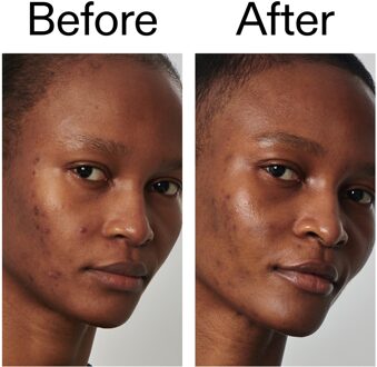 Super Solutions Serum 20% Niacinamide 30 ml