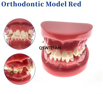 Tandarts Orthodontische Tand Model Demonstratie Onderwijs Arts-Patiënt Communicatie Model Onderwijs Onderzoek Modellen 1stk rood