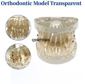Tandarts Orthodontische Tand Model Demonstratie Onderwijs Arts-Patiënt Communicatie Model Onderwijs Onderzoek Modellen 1stk transparant
