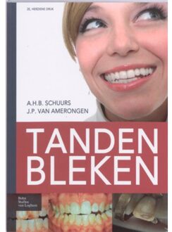 Tanden bleken - Boek Springer Media B.V. (903136035X)