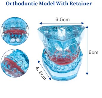 Tandheelkundige Functionele Orthopedische Wiht Retainer Model Tanden Model Dental Teach Studie Functional Orthopedi