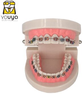 Tandheelkundige Model Met Beugel Tandheelkunde Materialen Orthodontische Modellen Gum Tand Tanden Model Voor Studeren Onderwijs Patiënt Onderwijs
